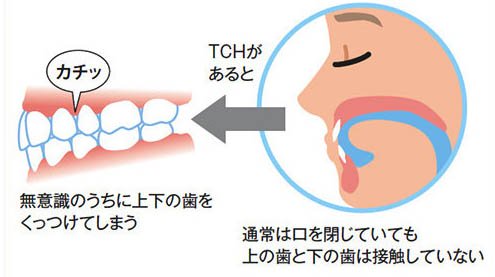 磯子の歯医者、羽田歯科医院で顎関節症の治療